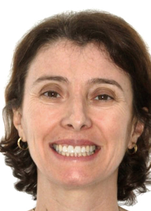 face_final - Falta de Espaço - Tratamento sem Extração