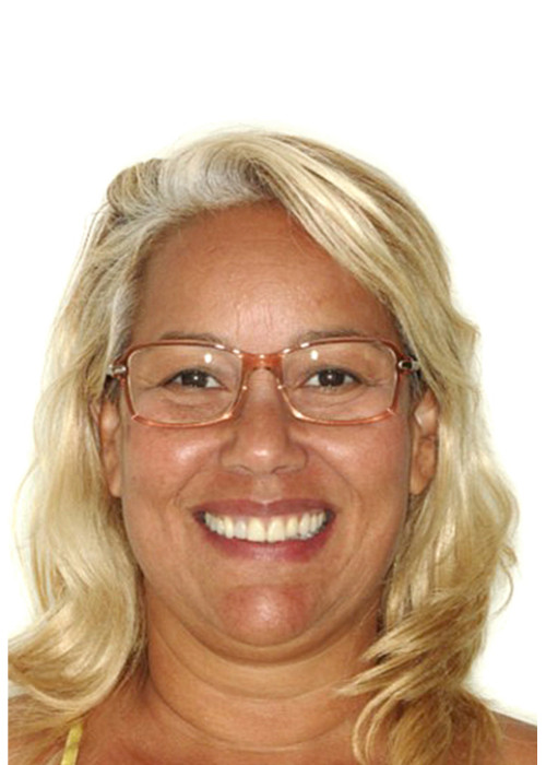 face_final - Tratamentos em Adultos 1