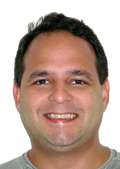 face_final - Disjunção Cirúrgica e Avanço Mandibular