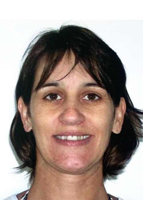 face_final - Extração de Incisivo Inferior
