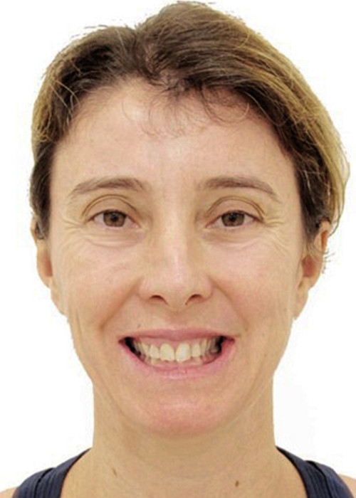 face_final - Falta de Espaço - Tratamento sem Extração