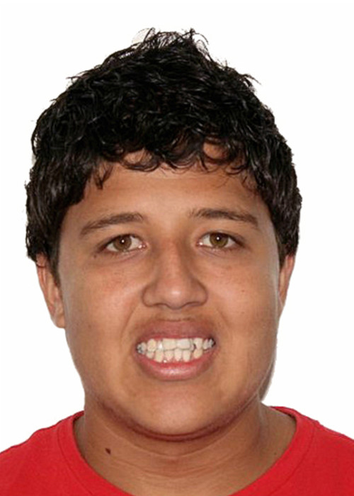 face_final - Tratamentos em Adultos 3