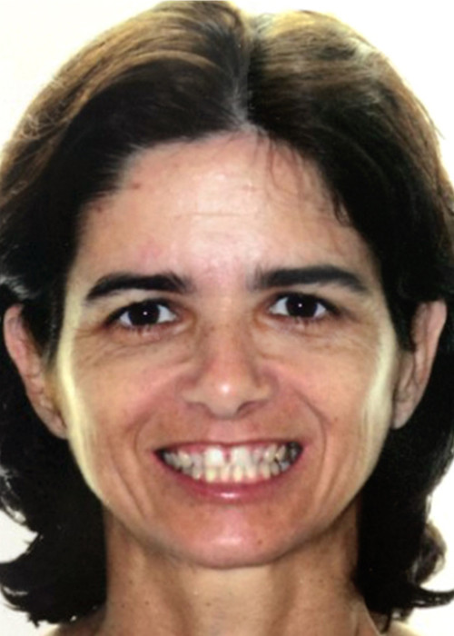 face_final - Tratamentos em Adultos 4